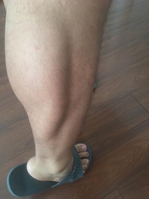 抖腿能瘦肌肉腿吗_肌肉大象腿怎么快速瘦下来_大象腿七天瘦出铅笔腿