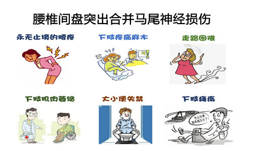 治疗腰椎肩盘突出医院_腰椎尖盘突出看哪个科_健康之路腰椎间盘突出