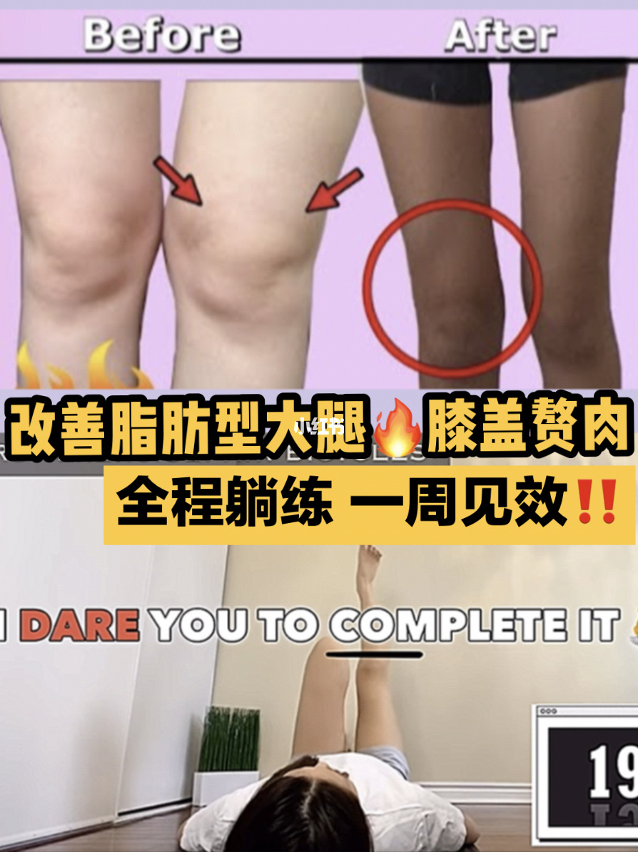 男生减肌肉腿_小腿上都是肌肉怎么减_腿和胳膊上肌肉疼怎么回事