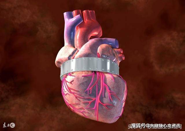 有什么运动对心脏好_心脏运动踏板试验_运动后心脏疼了一夜