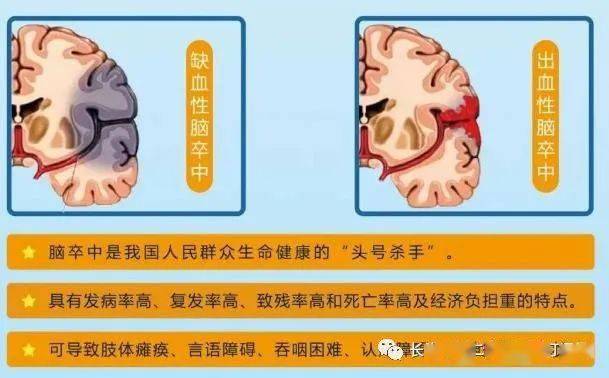 运动后心脏疼_有什么运动对心脏好_运动后心脏疼了一夜