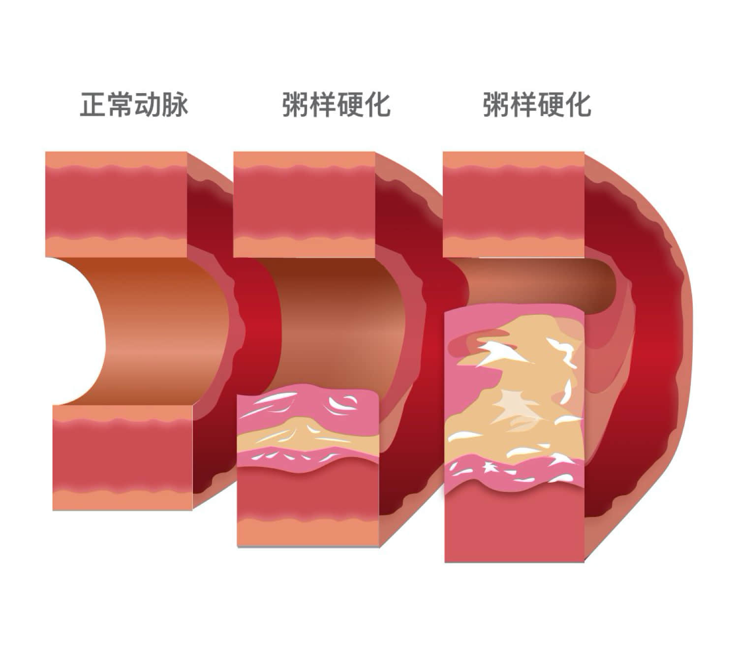 运动后心脏疼_运动后心脏疼了一夜_有什么运动对心脏好