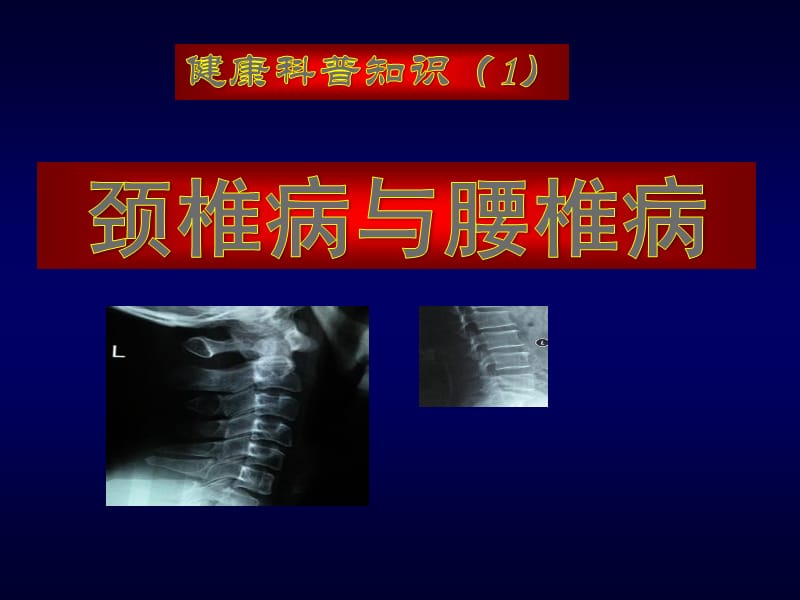 颈椎盘突出能治好吗_怎样治疗颈椎盘突出_颈椎间盘突出的锻炼