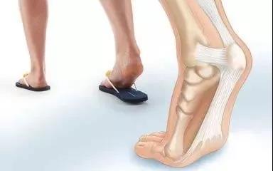 走路脚足痛是什么原因_脚 痛 走路后缓解_脚走路没力气是什么原因