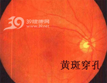 剧烈运动后突然双眼看不见_孕12周运动后突然出血_半夜心脏突然剧烈跳动