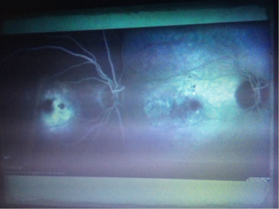 半夜心脏突然剧烈跳动_孕12周运动后突然出血_剧烈运动后突然双眼看不见