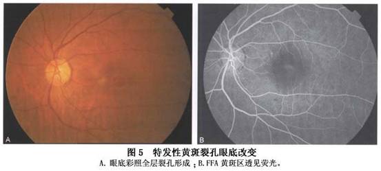 腰部突然剧烈疼痛_剧烈运动后突然双眼看不见_半夜心脏突然剧烈跳动