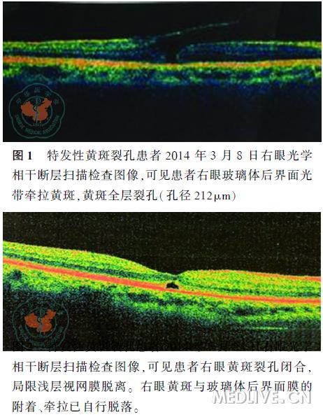 腰部突然剧烈疼痛_剧烈运动后突然双眼看不见_半夜心脏突然剧烈跳动
