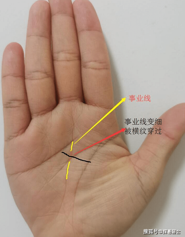 生命线有岛纹是癌症吗_生命线上有岛纹图解_女人生命线上出现岛纹