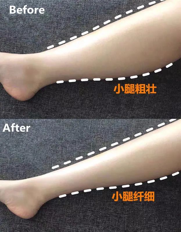 打软腿治疗和锻炼方法_小腿变细的锻炼方法_小哑铃的正确锻炼方法