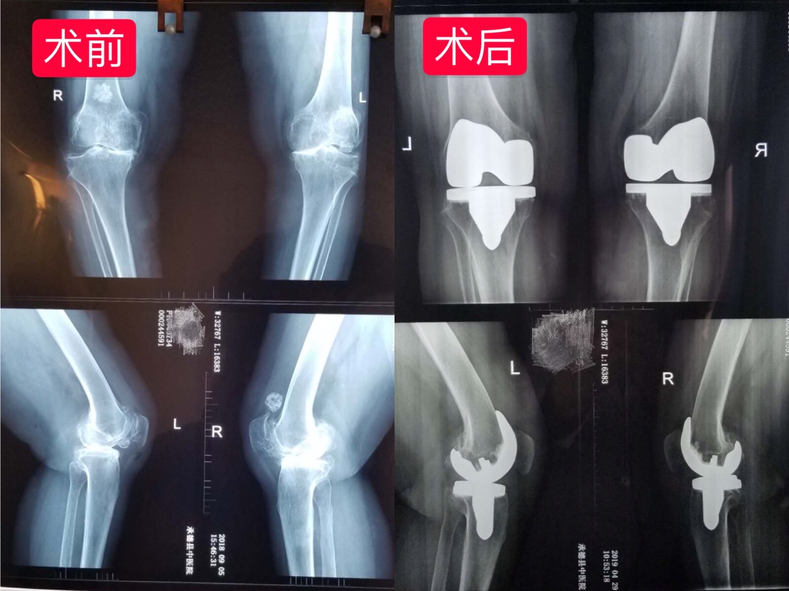 保护膝盖的运动方法_运动时如何保护膝盖_保护膝盖的运动方法