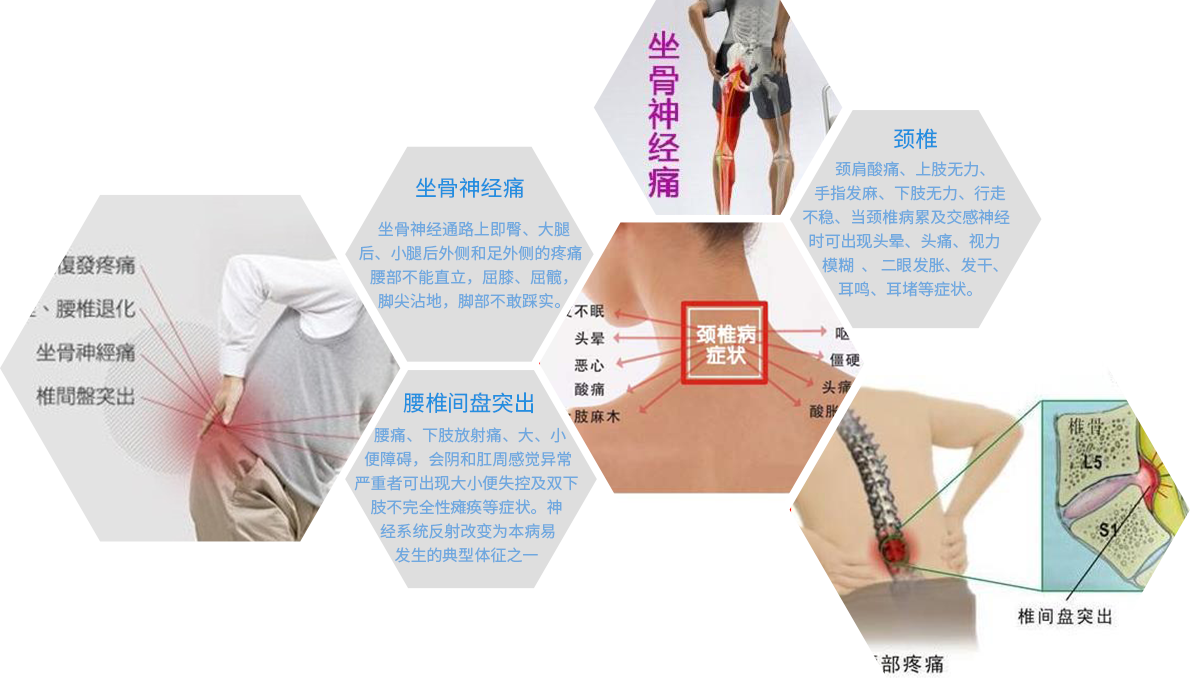 腰椎膨出怎么锻炼图片_腰椎间盘怎么锻炼图片_腰椎突出锻炼方法图片