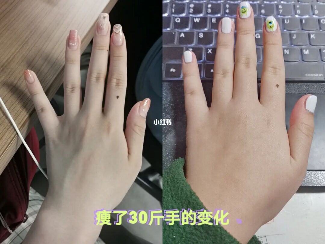 手臂粗是什么原因怎么能减掉_手臂蝴蝶袖多久能减掉_如何减掉手臂的的肌肉？
