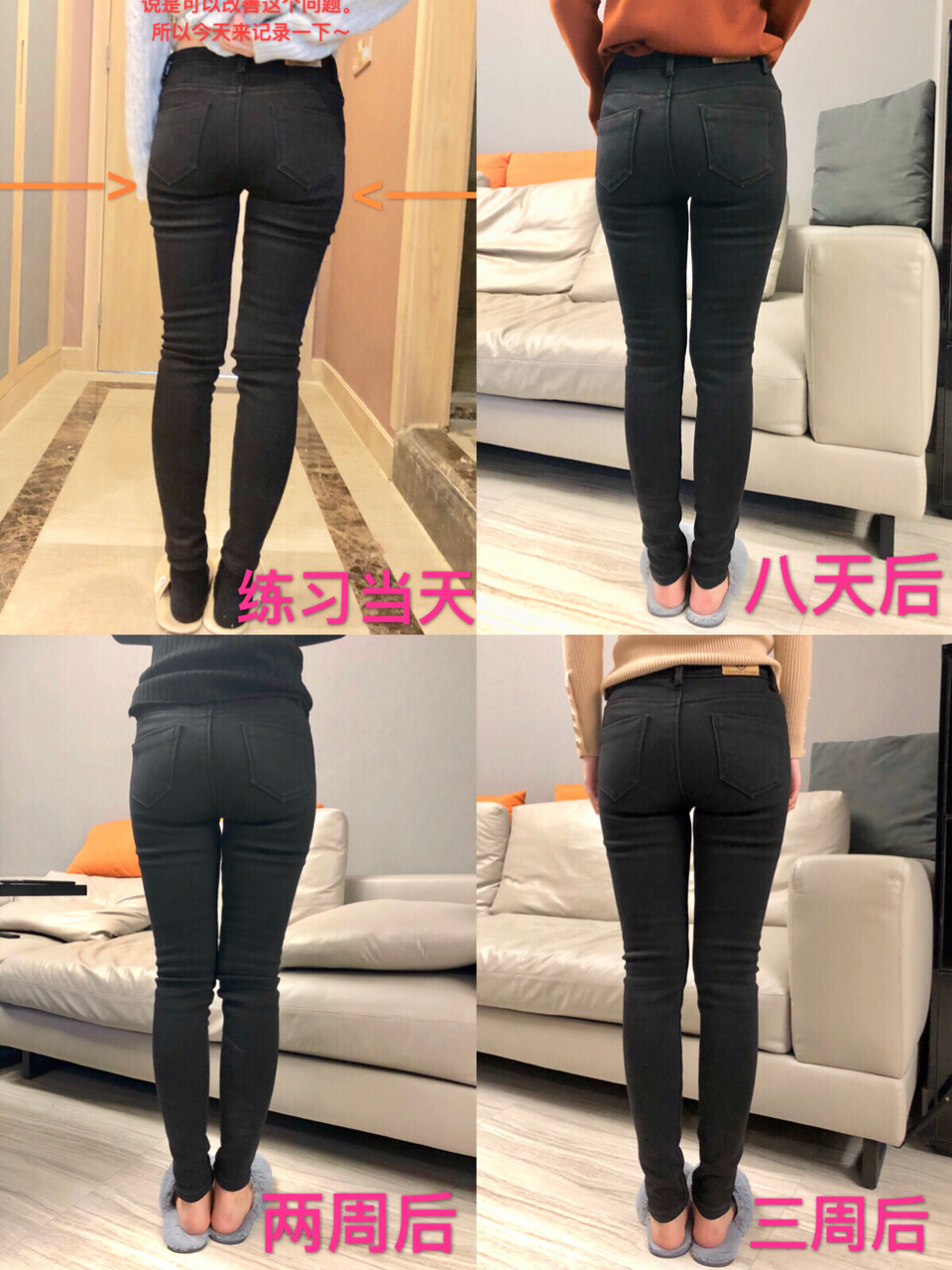 假胯宽是能矫正过来吗_半个月矫正假胯宽_吸脂可以矫正假胯宽