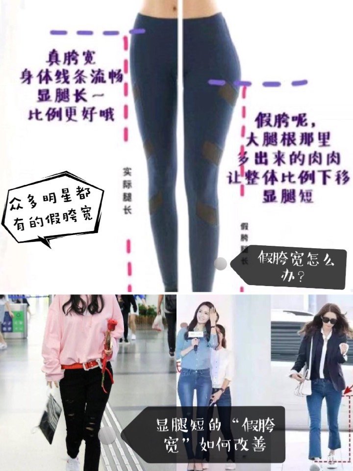 假胯宽是能矫正过来吗_假胯宽睡觉怎么矫正_假胯宽是能矫正过来吗