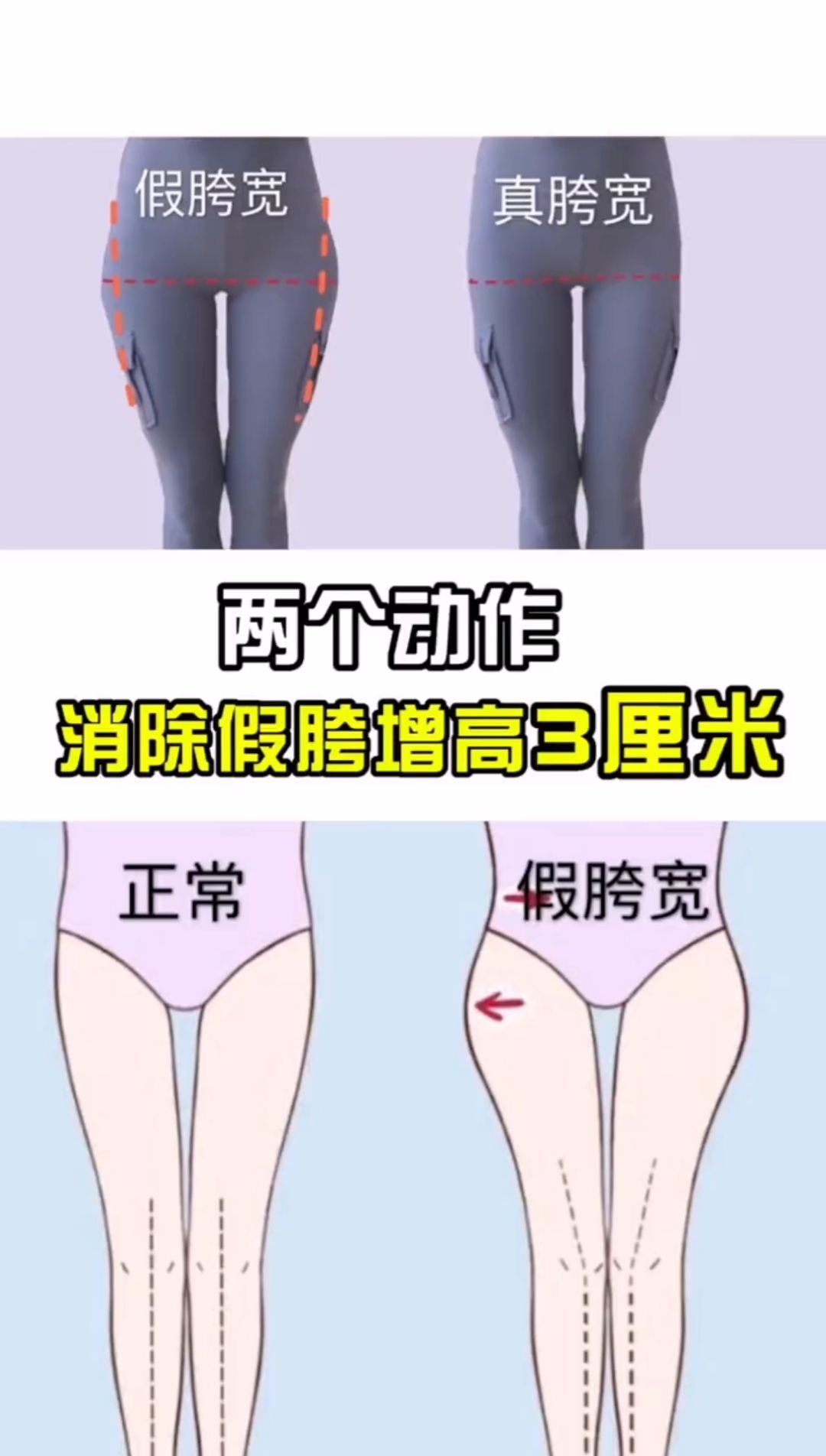 胯宽怎么矫正_假胯宽是能矫正过来吗_假胯宽能矫正姿势图