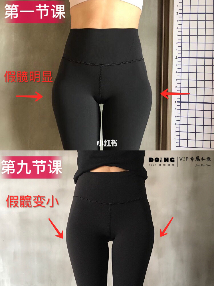 假胯宽是能矫正过来吗_假胯宽能矫正姿势图_胯宽怎么矫正