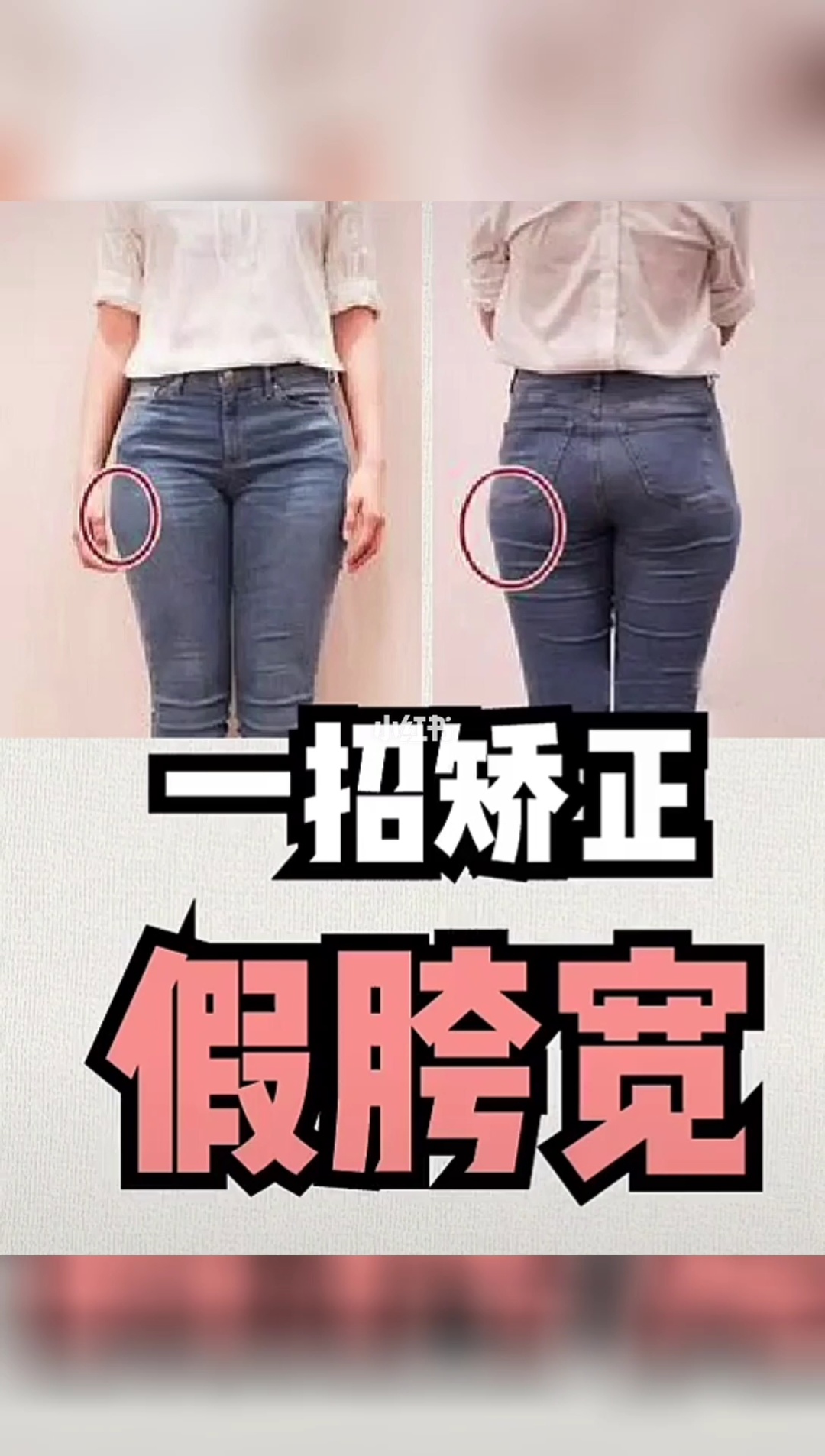 胯宽怎么矫正_假胯宽是能矫正过来吗_假胯宽是能矫正过来吗