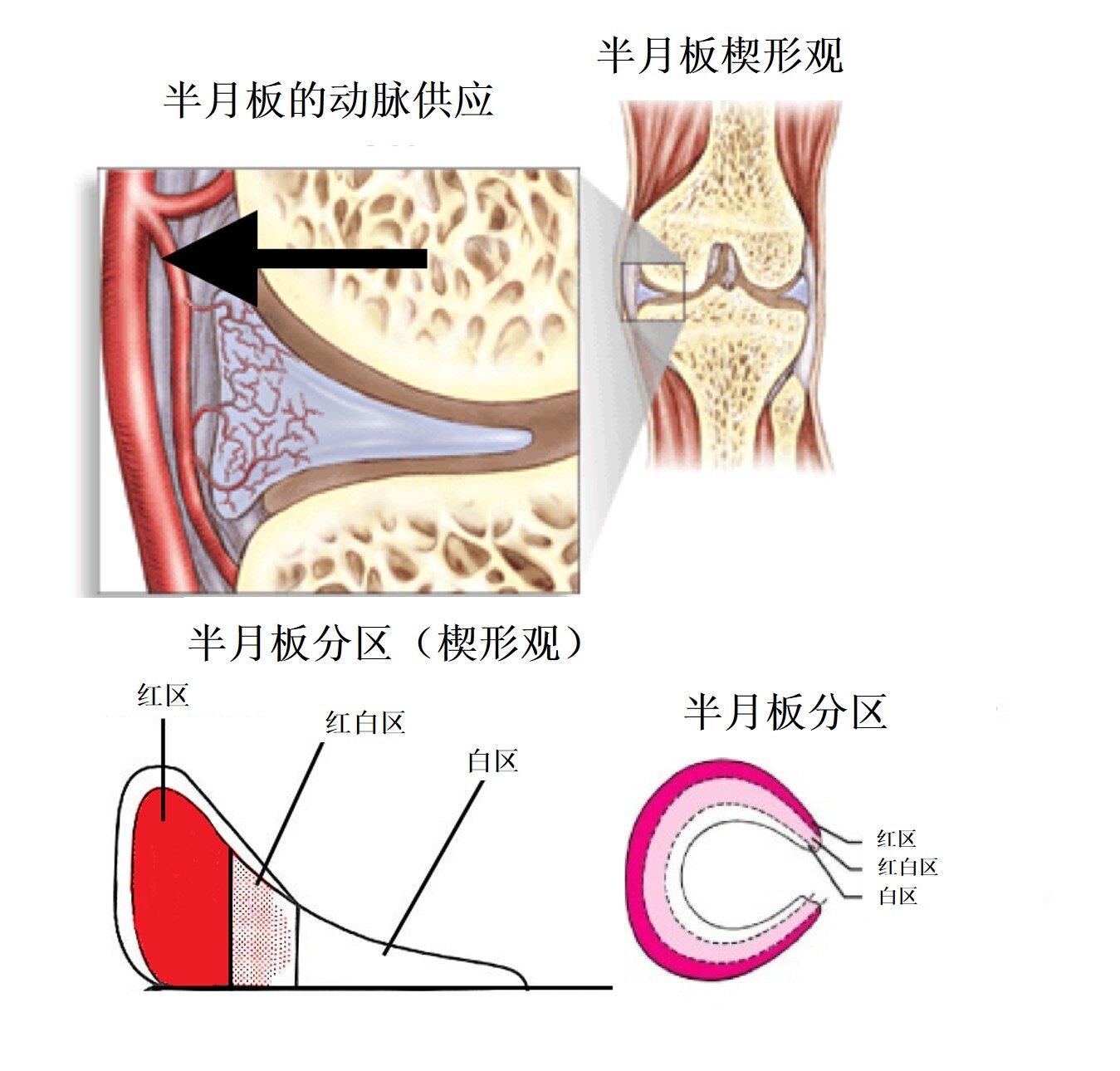 心肌损伤还能活多久_黄疸引起听力损伤还能恢复吗_半月板损伤还能跑步吗