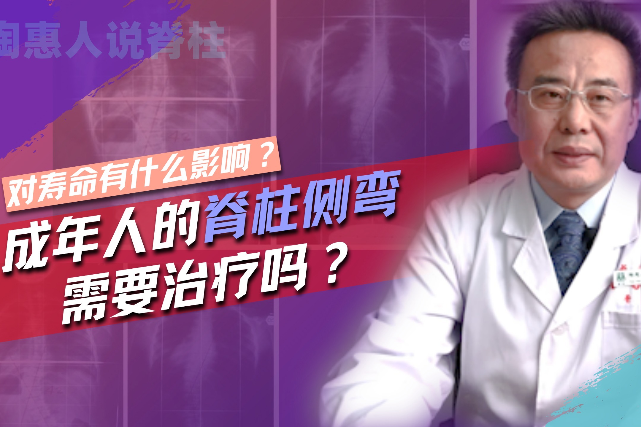 腰部脊柱弯腰疼_脊柱侧弯不能做的运动_做运动能治好声带息肉吗