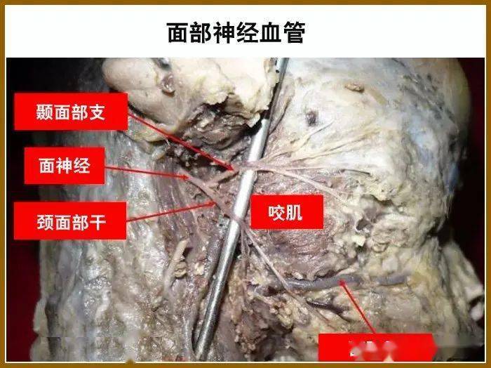 汉中梆梆面做面师傅_面神经电图哪里能做_双通道神经肌肉电刺激仪