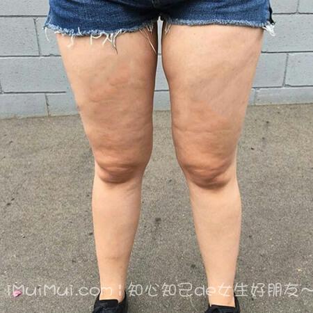 怎样跑步可以瘦小腿_跑步可以使小腿变瘦吗_每天跑步可以瘦肚子吗