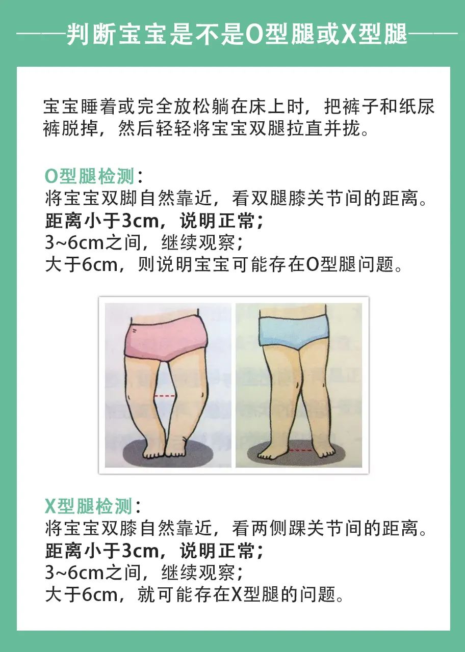 盘腿坐能矫正x型腿吗_怎样矫正x腿型_x腿型矫正带