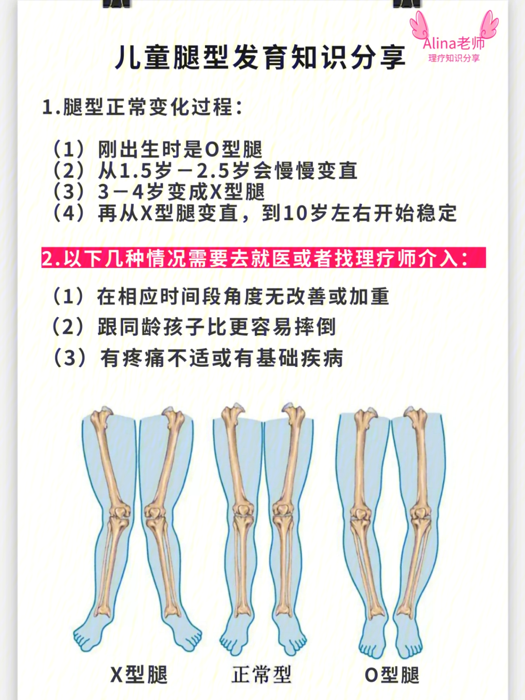 盘腿坐能矫正x型腿吗_怎样矫正x腿型_x腿型矫正带