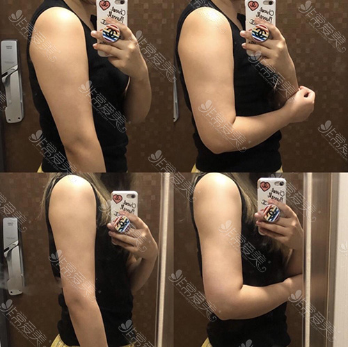 松板肉和猪梅肉_健身一周大腿上的肉由紧变松_用什么紧大腿的肉
