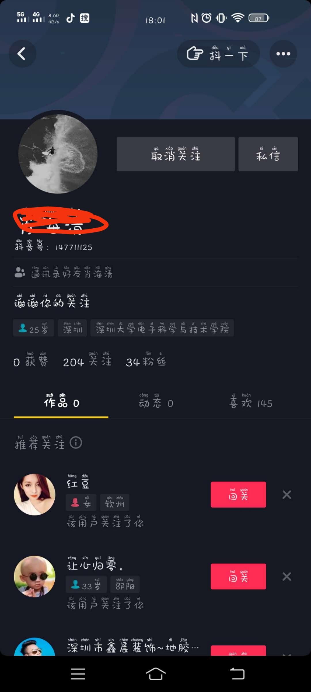 抖音买1000粉多少钱_抖音购买1000粉_买抖音粉1000个多少钱