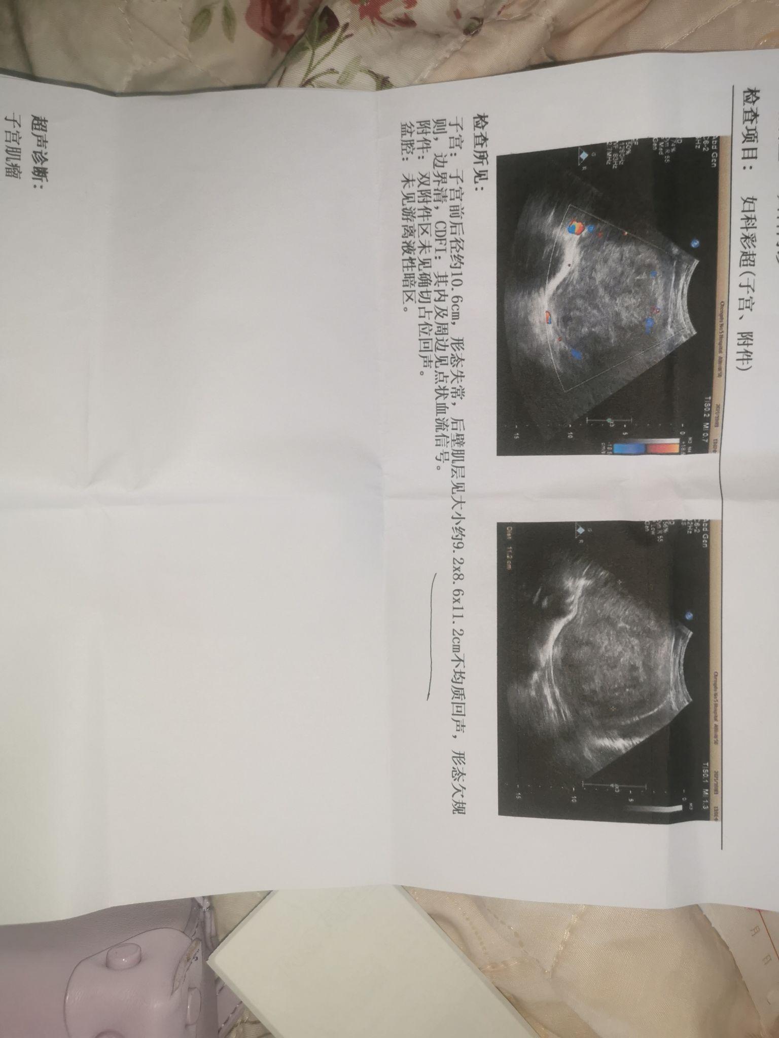 时间指标的特点有_乙肝五项指标的说明_有roc指标的软件