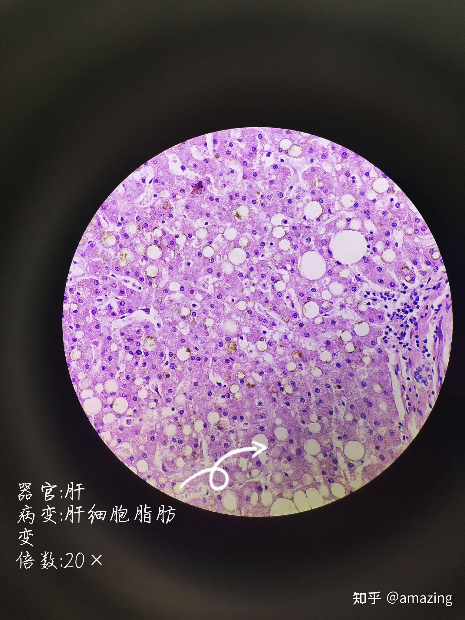 有没有专业点赞的平台_有赞业务_有赞平台好做吗